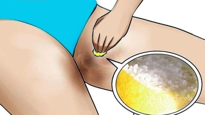 Creme caseiro para clarear a virilha
