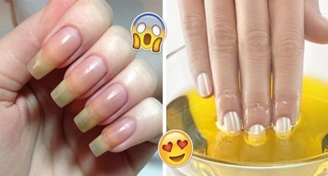 Receita caseira para fazer as unhas crescerem (2)
