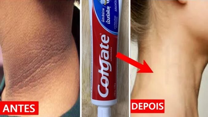 PASTA DE DENTE Para Clarear o Pescoço